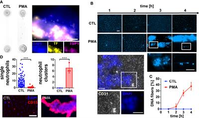 Impact of neutrophil extracellular traps on fluid properties, blood flow and complement activation